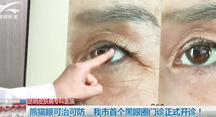 熊猫眼可治可防，我市首个黑眼圈门诊正式开诊!