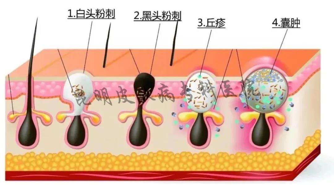 昆明哪家医院看疤痕病看的好